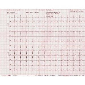 Paper EKG Bionet Red Grid Cardiocare EKG 2000 (EKG-GP) by Clinical Health Products  ID B-ECG-P10